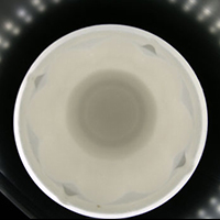Inner macula