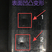 Outer arc abnormality